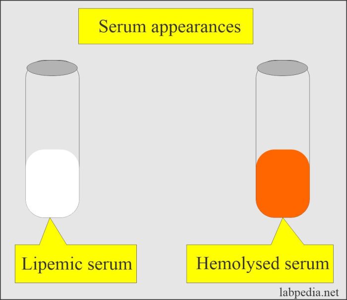 Knowledge drill 9-7 serum appearance